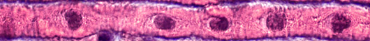 Centronuclear Myopathy
